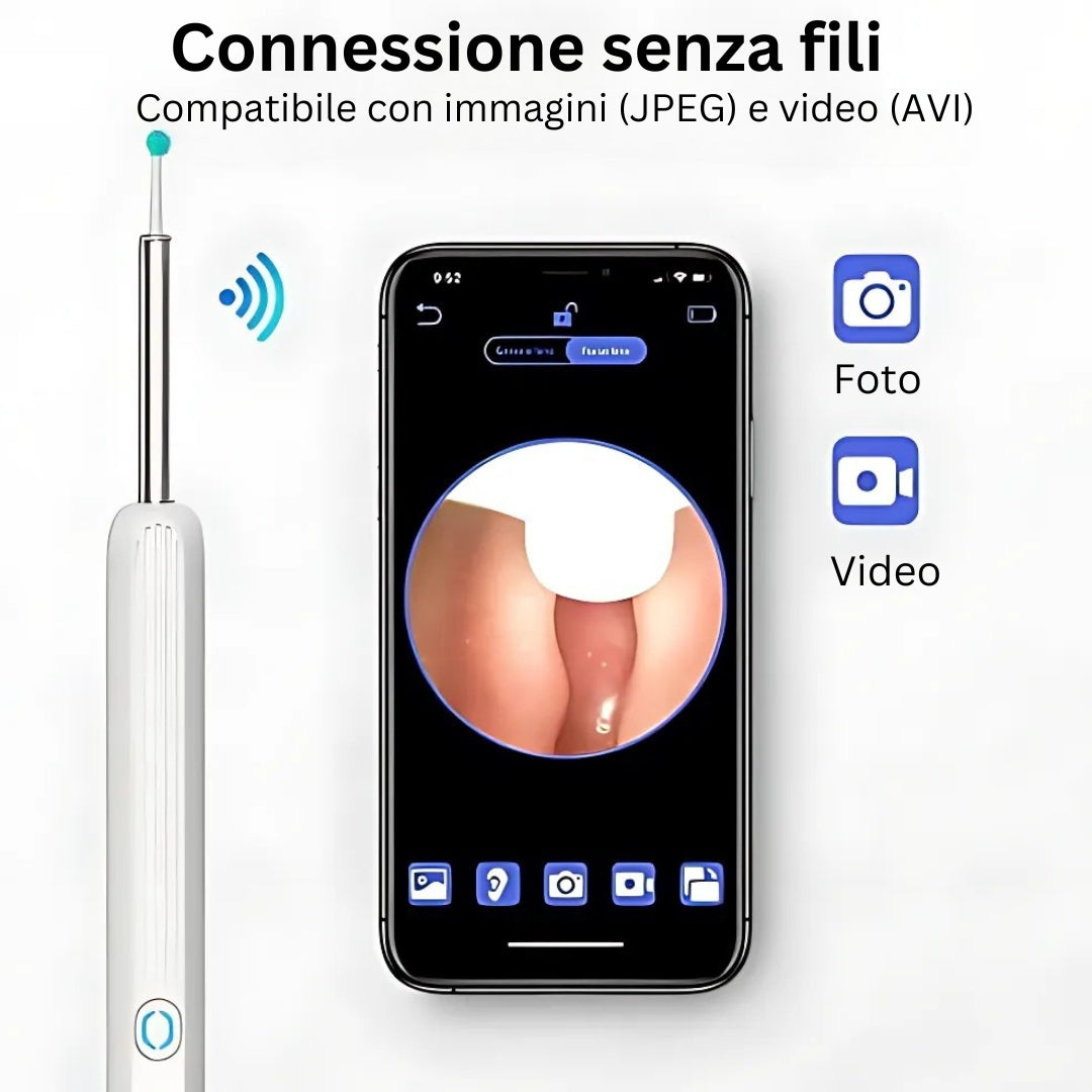 ClearView Pro | Pulitore per Orecchie con Telecamera HD