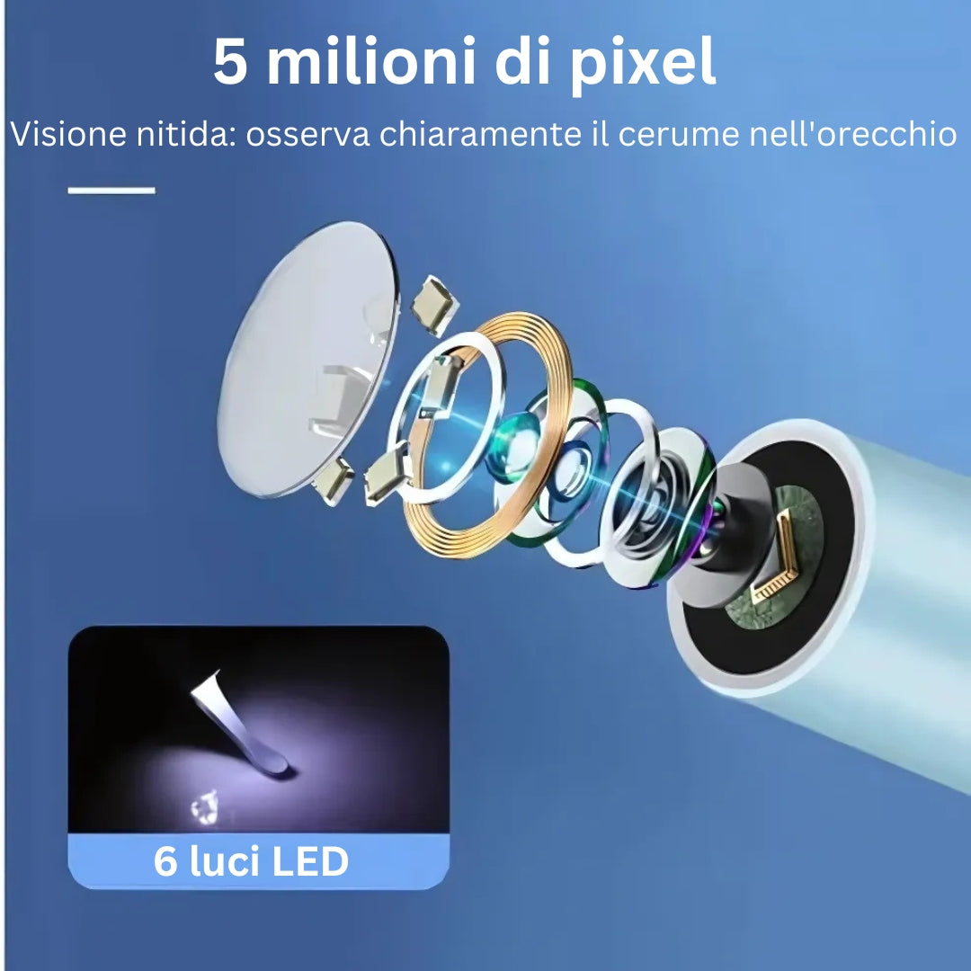 ClearView Pro | Pulitore per Orecchie con Telecamera HD