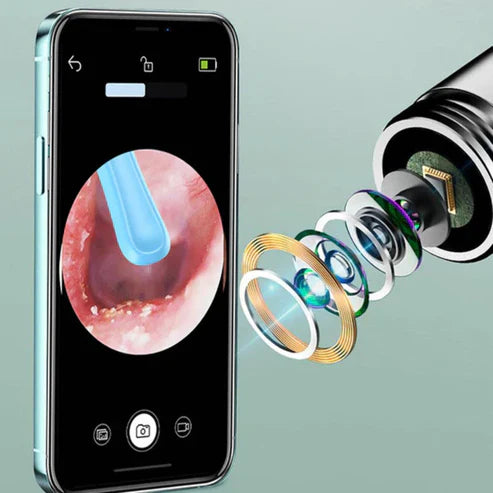 ClearView Pro | Pulitore per Orecchie con Telecamera HD