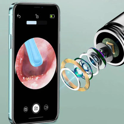 ClearView Pro | Pulitore per Orecchie con Telecamera HD