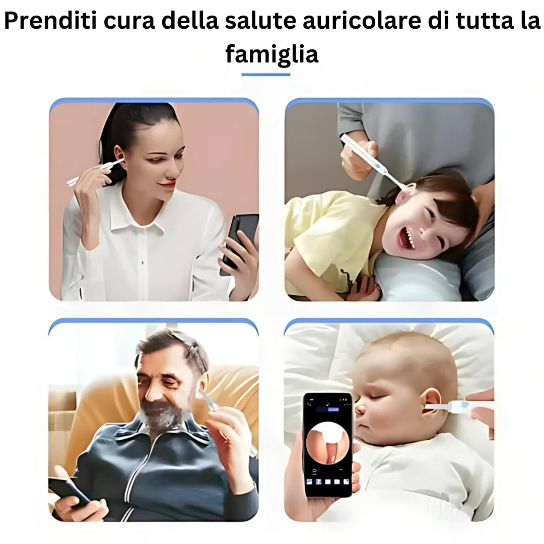ClearView Pro | Pulitore per Orecchie con Telecamera HD